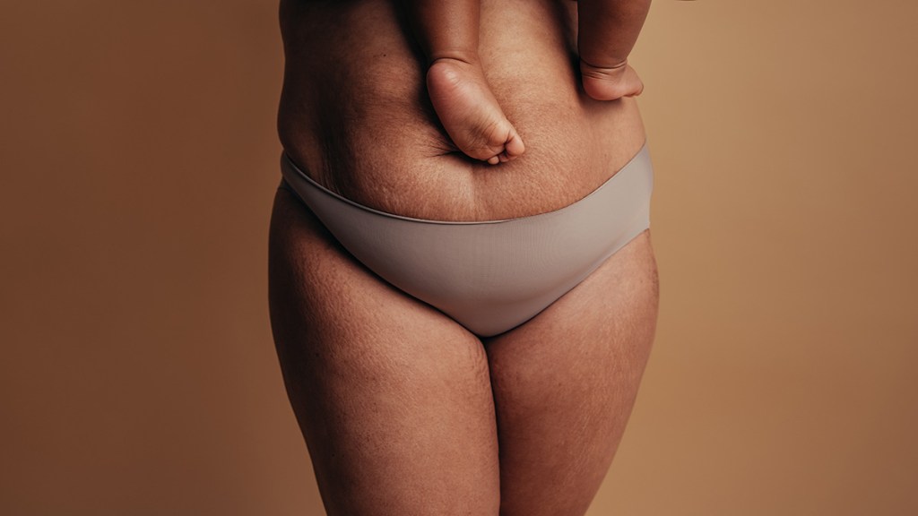 Postpartum Body Image: Understanding & Embracing Changes